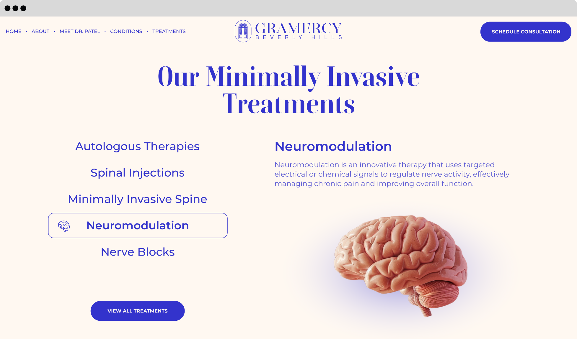 Website section displaying minimally invasive treatments, including neuromodulation, with a 3D-rendered brain illustration. Designed by Wanted for Nothing.