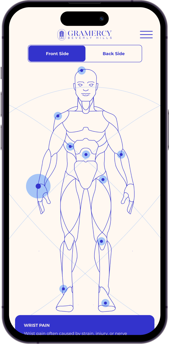 Mobile interface of Gramercy Center's interactive pain diagnosis tool, highlighting pain points on a human body diagram. Designed by Wanted for Nothing.